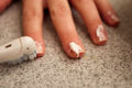 remove tobacco stains from fingers How to Remove Nicotine Stains From  Fingers Naturally
