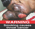 Warning - Smoking causes throat cancer